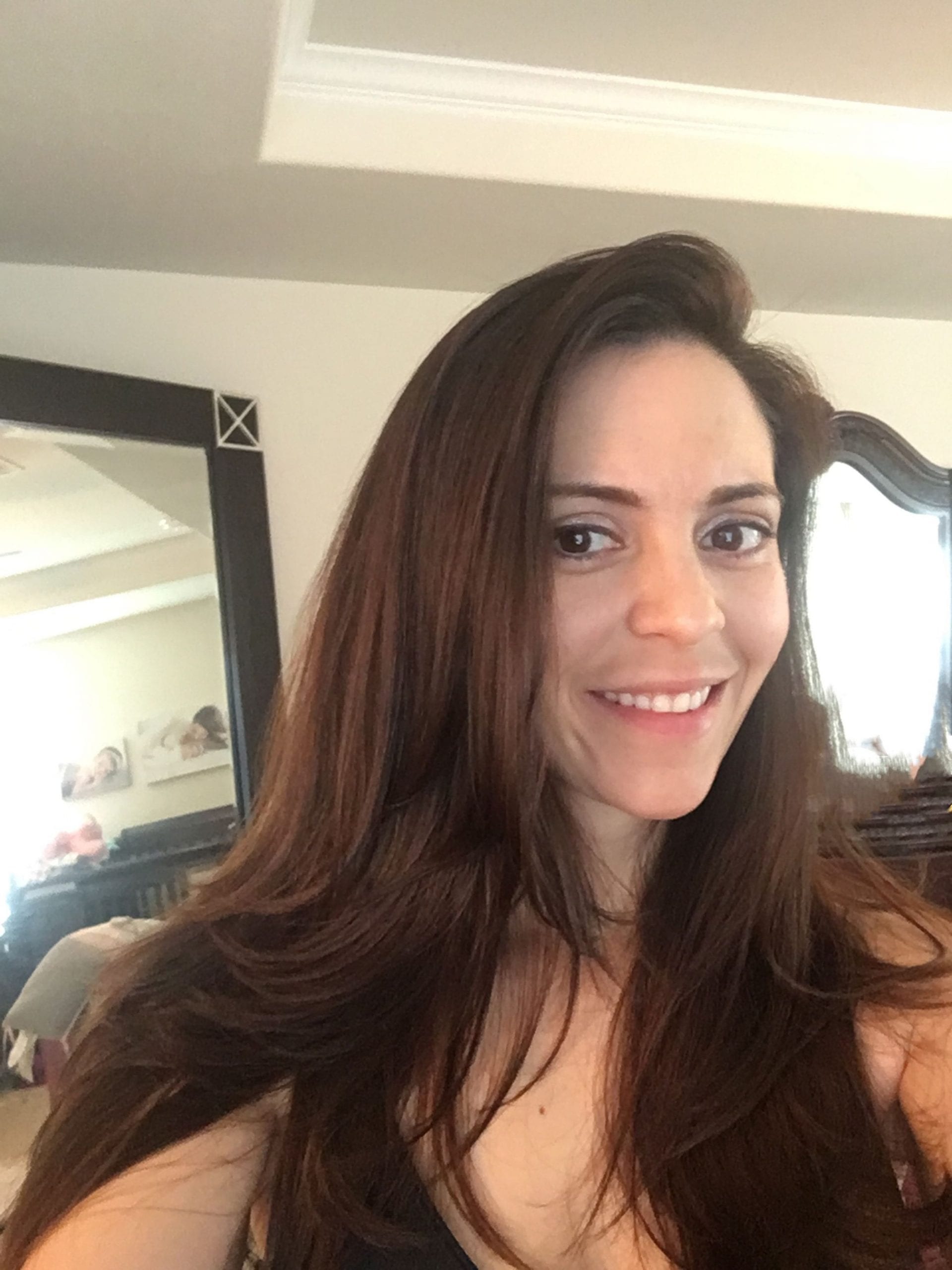 Elle dépense un montant incroyable en chirurgie pour ressembler à Meghan Markle (photo)