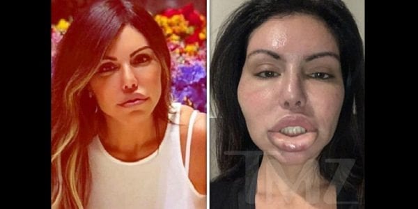 Mannequin Defiguree Par La Chirurgie Esthetique