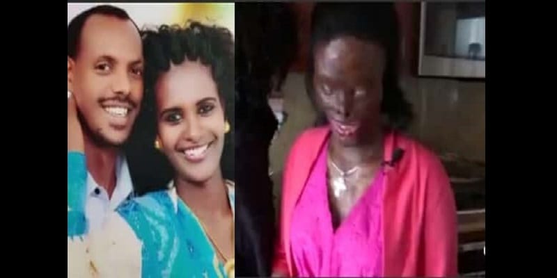 Woman-disfigured-blinded-by-acid-attack-by-her-abusive-husband-Photos