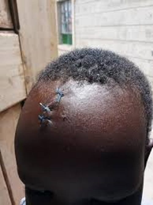 Kenya: Une domestique frappe la tête d’un enfant à l'aide d'une assiette