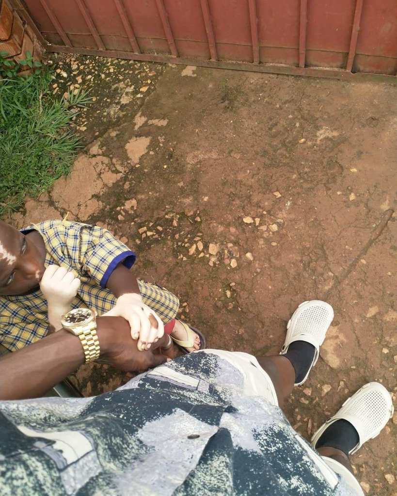 Ouganda: Un garçon fait sensation à cause de ses marques de naissance uniques