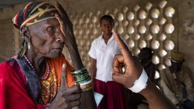 Problèmes oculaires