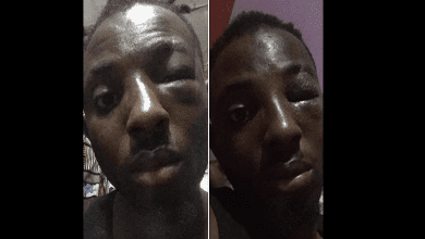 Ramske-Wire-Boyfriend-Beaten