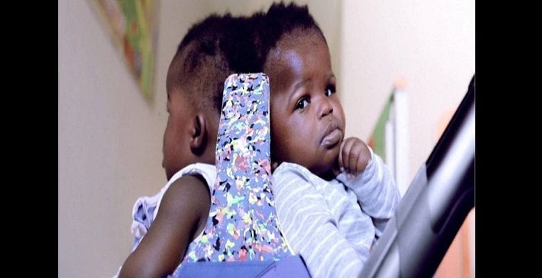 conjoined_twins-5f0781aee0a7442b5c9e5694_1_Jul_09_2020_21_26_41_poster