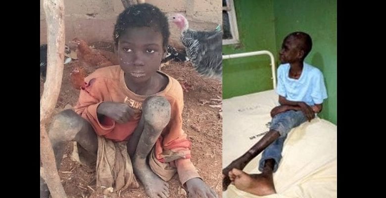 10-year-old-epileptic-boy-chained-by-parents-for-2-years-rescued-in-Kebbi-lailasnews