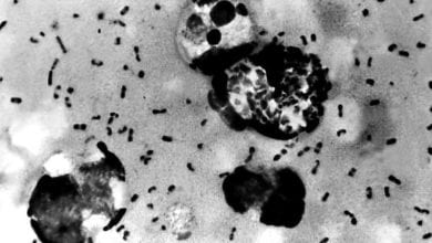 La-peste-bubonique-373073