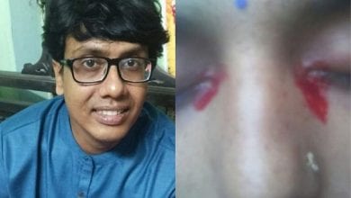 Shocking-see-moment-housewife-bleeds-from-her-eyes-during-her-period-really-baffles-her-doctors-1024×640