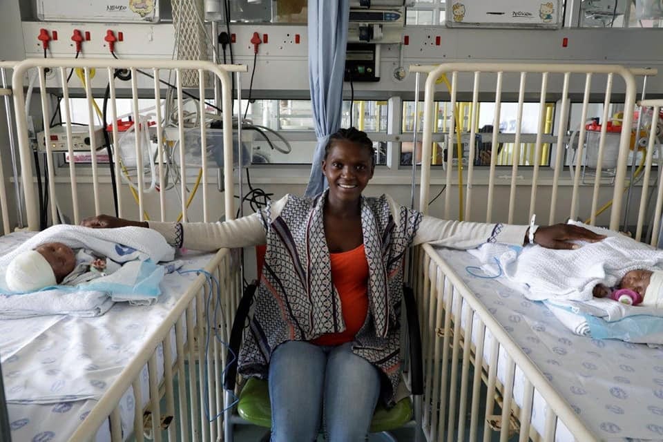 Des bébés siamois séparés avec succès en Afrique du Sud (Photos)