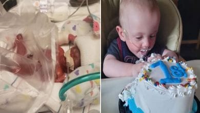 most-premature-baby-days-old-and-celebrating-first-birthday-with-cake_tcm25-663672 (1)