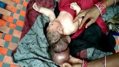 0_PAY-Woman-who-had-normal-pregnancy-gives-birth-to-THREE-HEADED-baby (1)