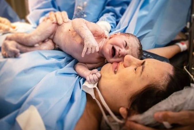 Brésil: un bébé naît tenant la bobine contraceptive de sa mère en main