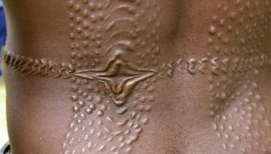 Question africaine 50 : Coronavirus, s'est-on résigné à vivre avec ?
