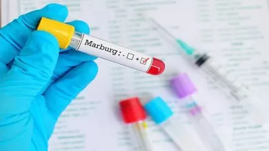 Blood sample positive with Marburg virus