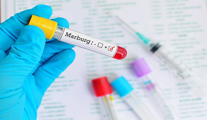 Blood sample positive with Marburg virus