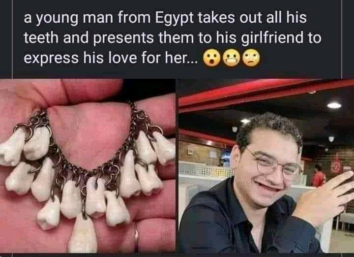 Un Égyptien fait arracher toutes ses dents pour exprimer son amour à sa petite amie