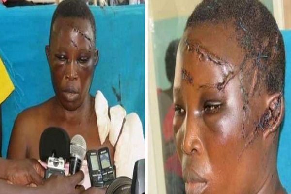 Man-hacks-wife-with-machete-for-denying-him-sex (1)