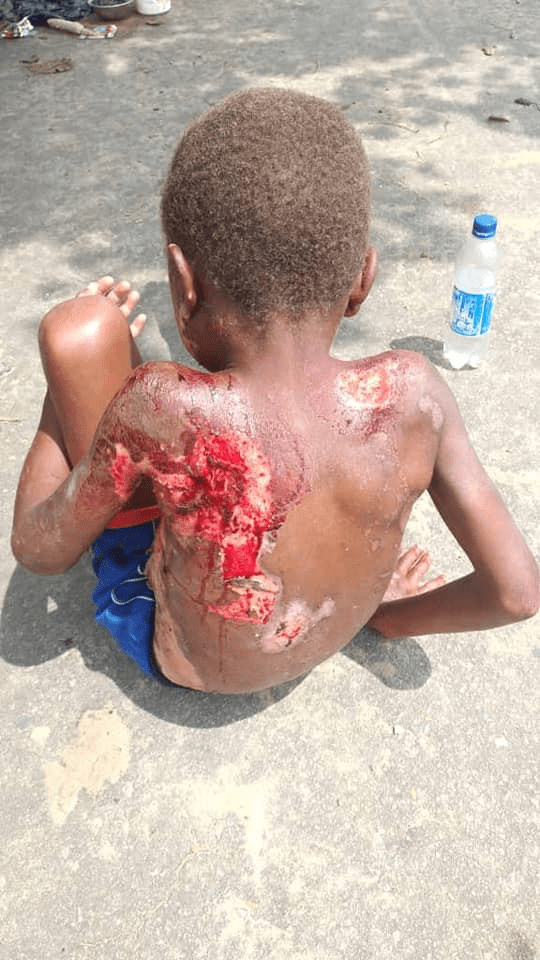 Nigeria: Un petit garçon qualifié de sorcier,  abandonné dans les rues-Photos
