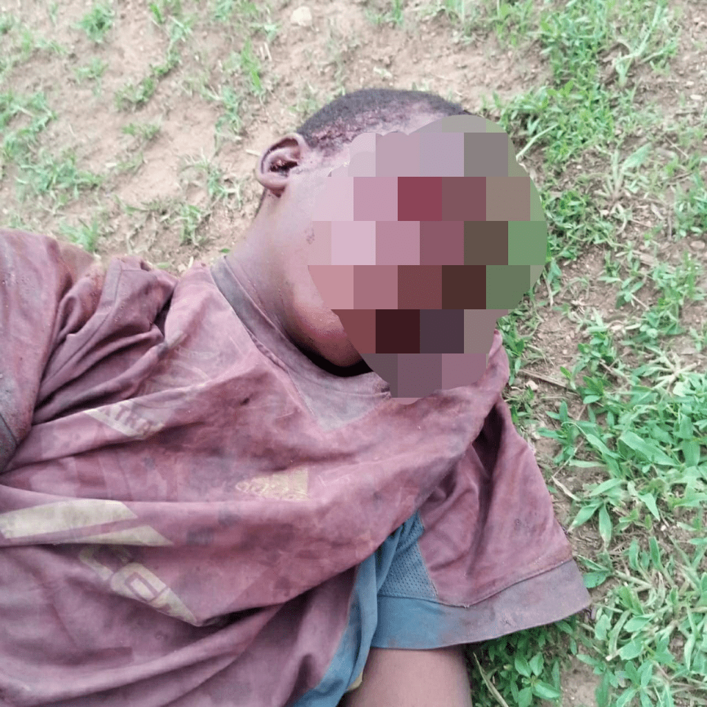 Nigeria : Les yeux d'un garçon de 16 ans arrachés par son "employeur"(photos)