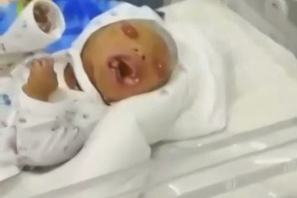 3_CEN-BloodRelatives-01