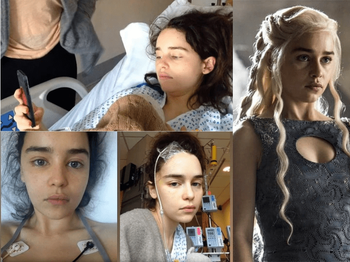 Emilia Clarke, l’actrice de «Game of Thrones», révèle vivre sans une partie de son cerveau
