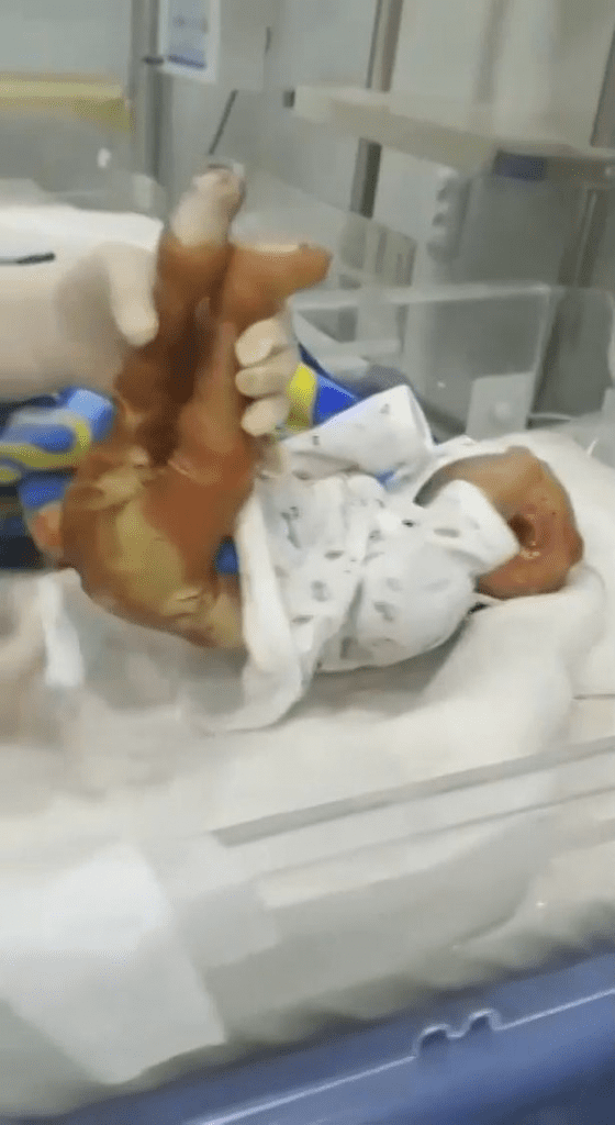 Un bébé issu d'un inceste meurt quelques heures après sa naissance