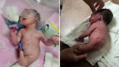 1_Baby-born-with-strange-horn-instead-of-legs-leaves-doctors-mystified