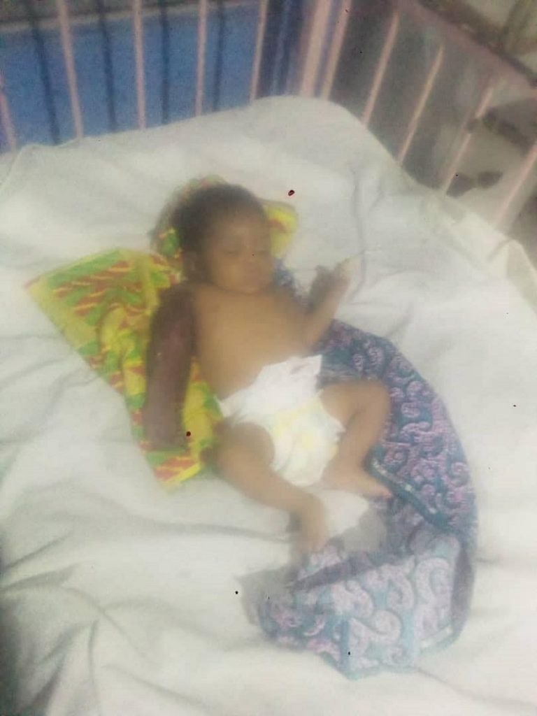 Un père bat et casse le bras de son bébé de 2 mois pour avoir perturbé son sommeil 