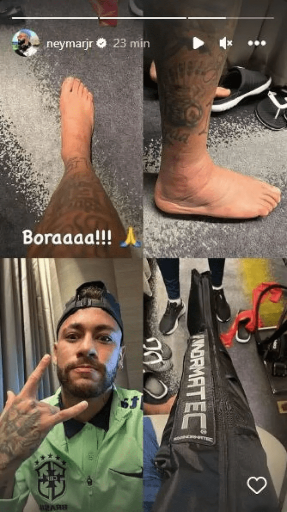 Neymar montre l'état inquiétant de sa cheville sur les réseaux sociaux - Photo