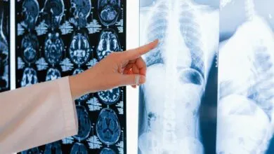 05e9adf639b8fdd3af30619133878b22