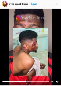 Cameroun / Un homme battu à sang parce que qualifié d'homos3xuel