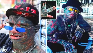 0_Most-modified-man-in-the-world-gets-hand-SPLIT-in-half-in-world-first-procedure