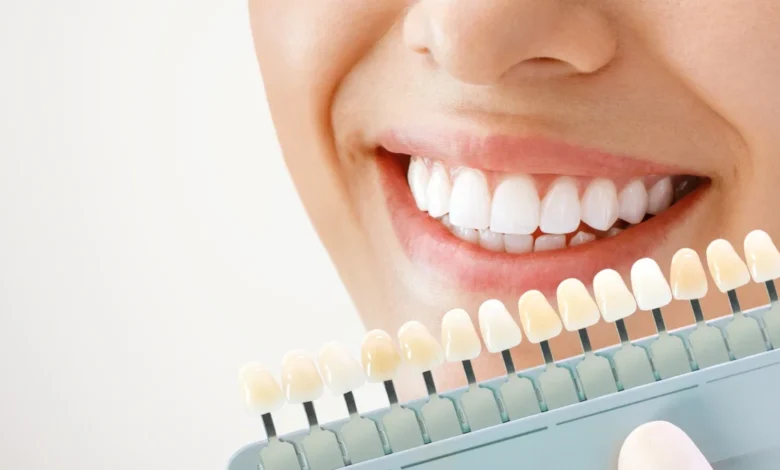 blanchir ses dents avec du vernis à ongles sur TIKTOK