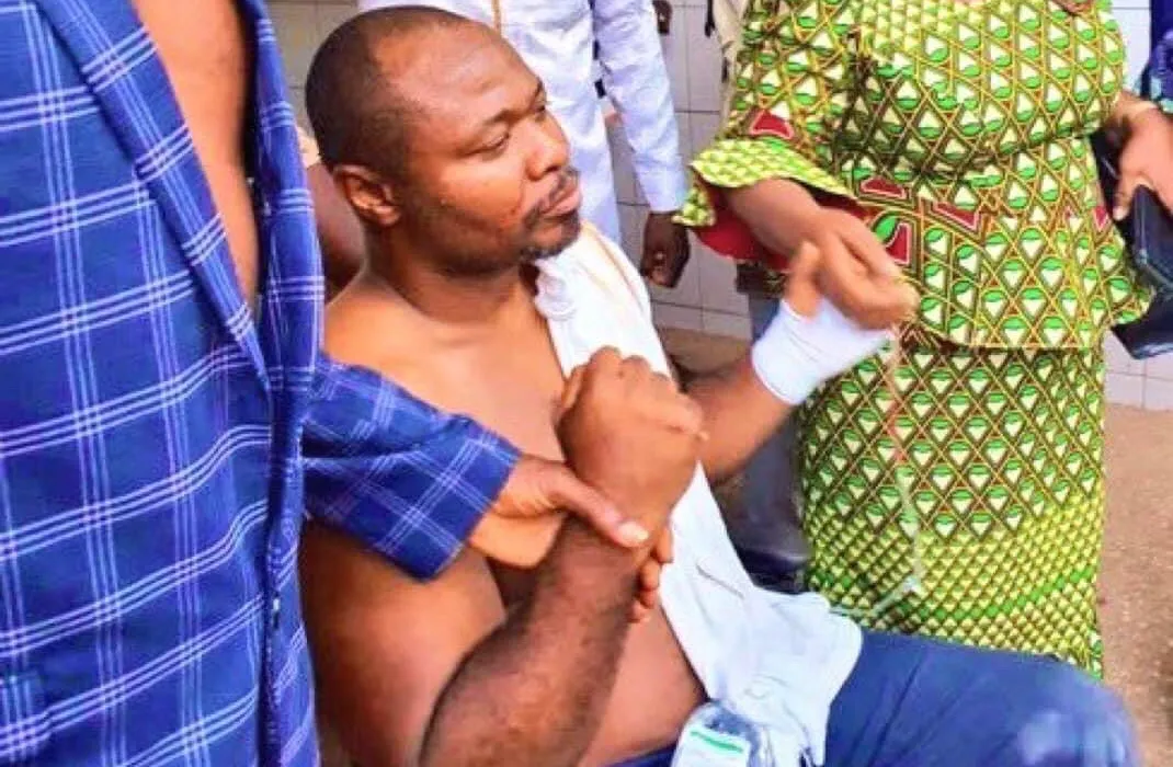 Guy Marius, député sénégalais, agr€ssé lors d’une réunion politique au Togo