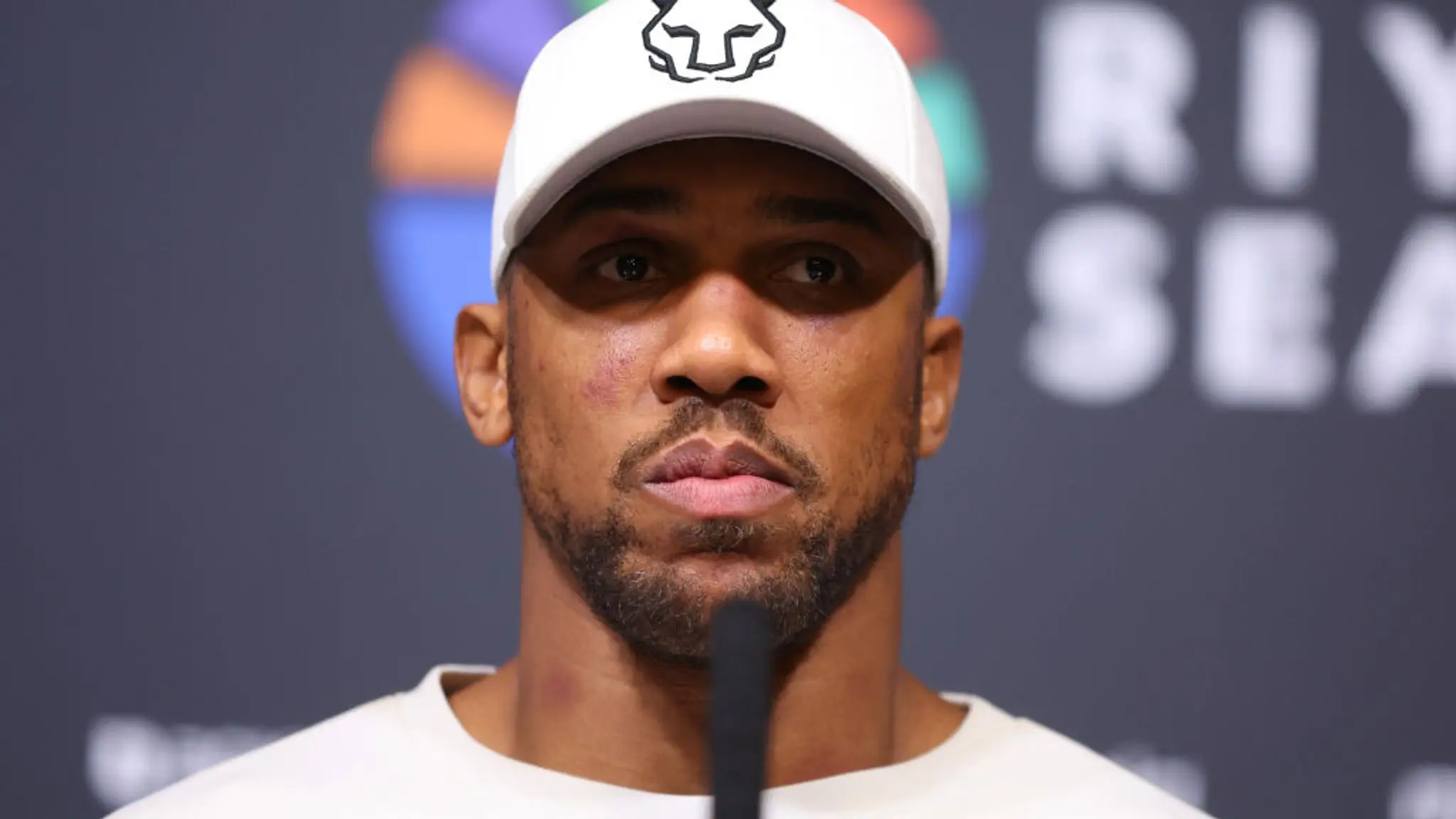 BOXE : Anthony Joshua va subir une intervention chirurgicale