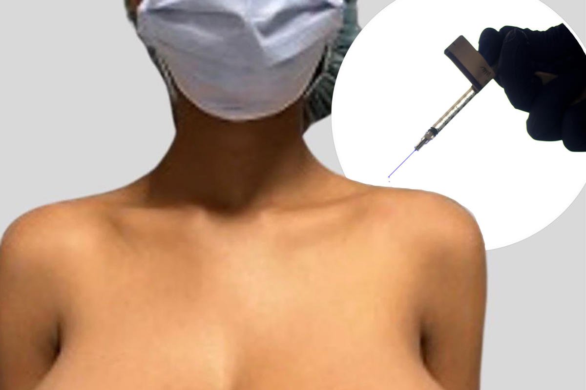 Les s3ins d’une adolescente ont triplé de volume après un vaccin contre le Covid, les experts réagissent
