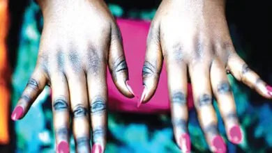 Top-7-des-pays-africains-où-la-population-blanchit-le-plus-la-peau-