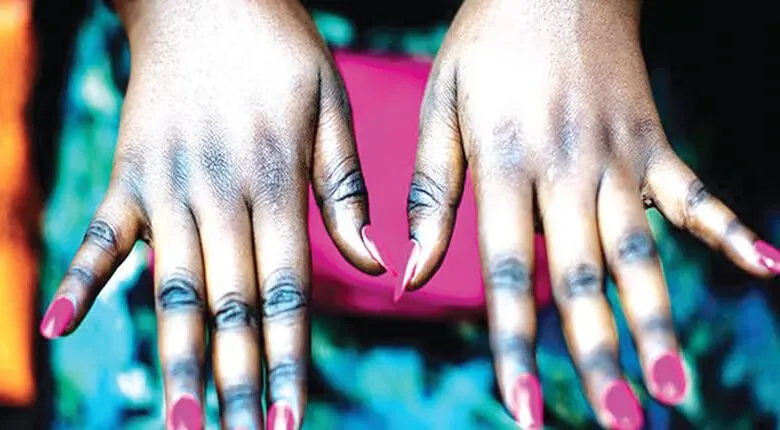 Top-7-des-pays-africains-où-la-population-blanchit-le-plus-la-peau-