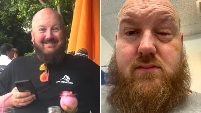 Un homme a utilisé le placenta d’une femme pour reconstruire son œil