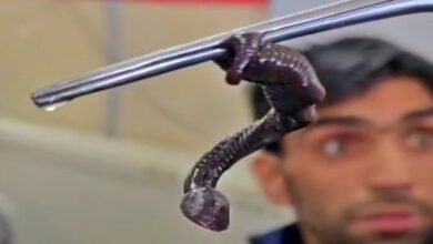 un vers ressemblant à un serpent retiré du nez d&rsquo;un garçon de 9 ans