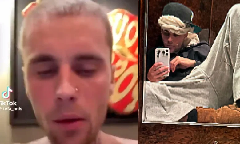 Justin Bieber inquiète ses fans