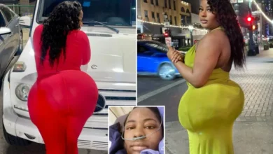 « Mon BBL est TROP gros et il a failli me tuer »