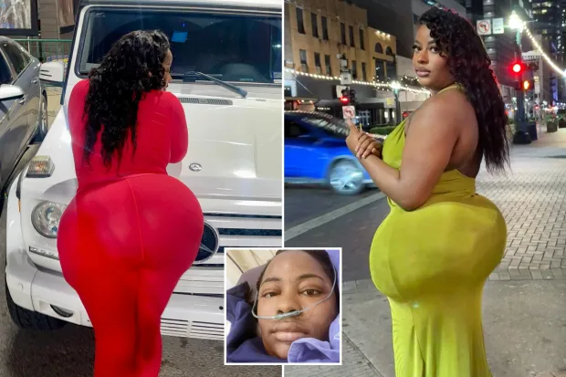 « Mon BBL est TROP gros et il a failli me tuer »