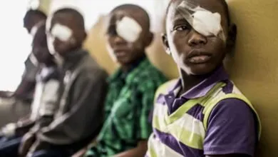 Santé-le-Sénégal-surmonte-un-problème-vieux-de-plusieurs-siècles-le-Trachome