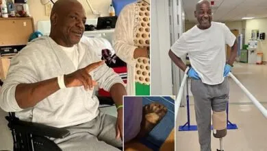 Un-Nigérian-perd-sa-jambe-après-une-pédicure-à-domicile-ratée-