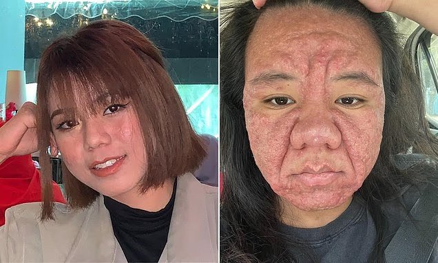 Une-femme-révèle-comment-les-hormones-de-grossesse-ont-rendu-son-visage-méconnaissable