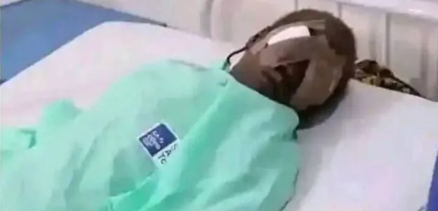 Un adolescent arrache les yeux de sa sœur de 7 ans pour un rituel d’argent