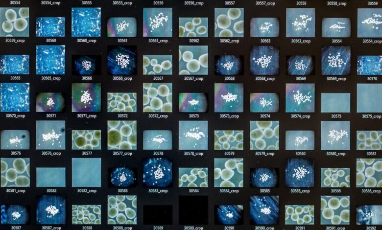 SWITZERLAND-SCIENCE-BRAIN-TECHNOLOGY-RESEARCH