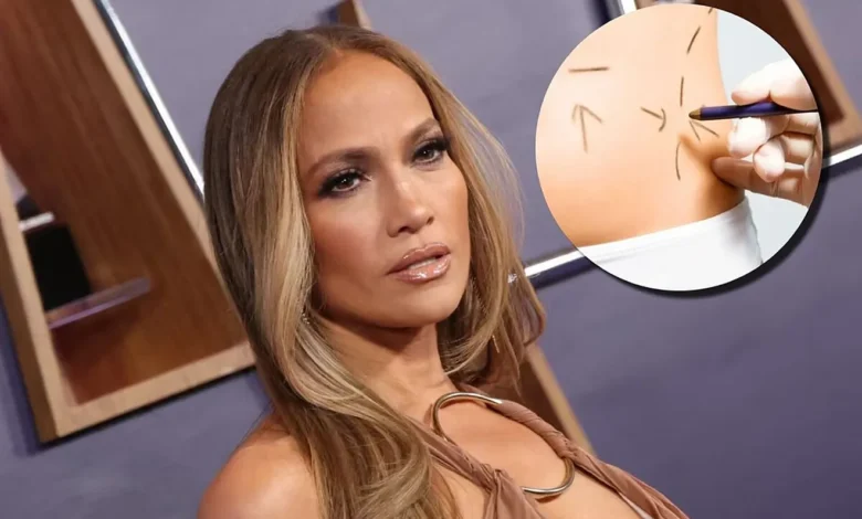 L’entourage de Jennifer Lopez est très inquiet pour sa santé