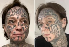 Une femme « forcée » de se faire tatouer le nom de son partenaire 250 fois sur le visage