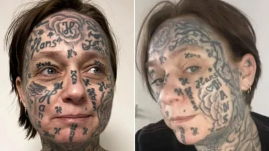 Une femme « forcée » de se faire tatouer le nom de son partenaire 250 fois sur le visage